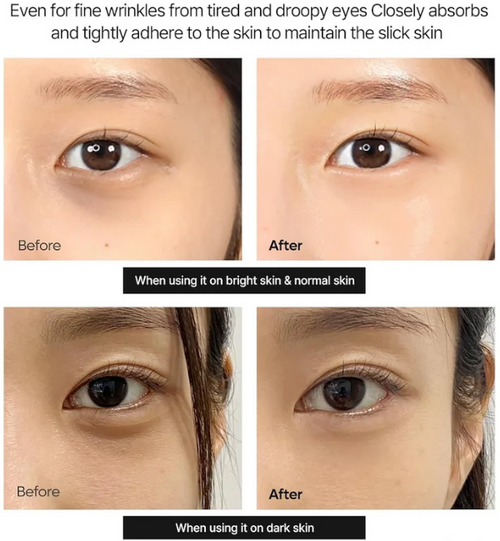 Calcium Dark Spot Eye Cream